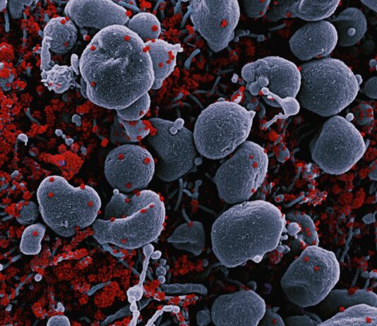 MZ세대, ‘마이크로바이옴’에 빠지다…장 속 균까지 관리한다 a bunch of red and white blood cells