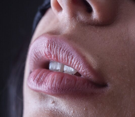 “자꾸 입술이 찢어지고 갈라져요”… 단순 건조 아닌 만성 염증 신호일 수도 person with red lipstick and black mascara